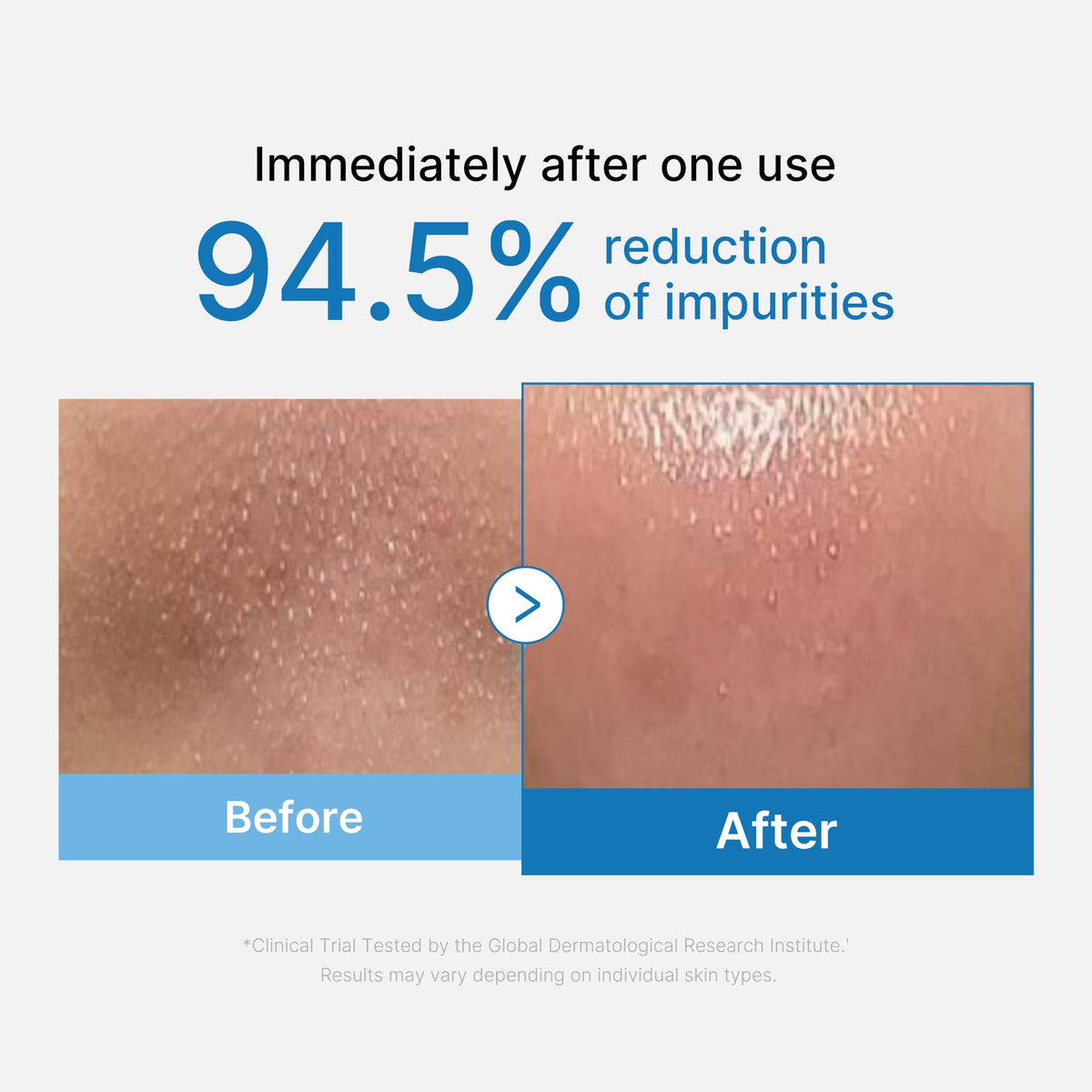 Medicube Zero Pore Blackhead Deep Cleansing — Óleo de Limpeza 205 ml — foto oficial da marca