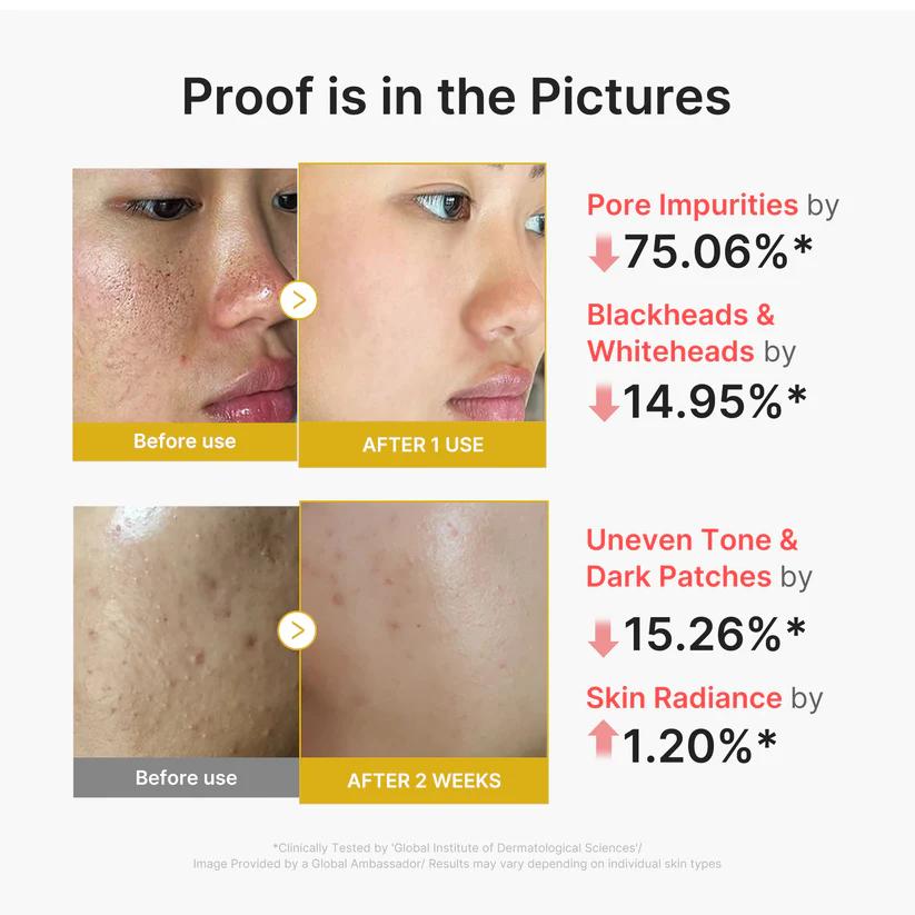 Medicube Kojic Acid Turmeric Peel Shot — 80 ml